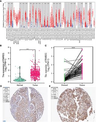 PIMREG is a prognostic biomarker involved in immune microenvironment of clear cell renal cell carcinoma and associated with the transition from G1 phase to S phase